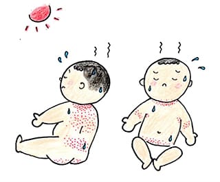 食物アレルギー アトピー性皮膚炎 ニコニコこどもクリニック 名古屋市中村区上石川町の小児科